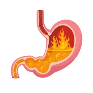 Acid Reflux